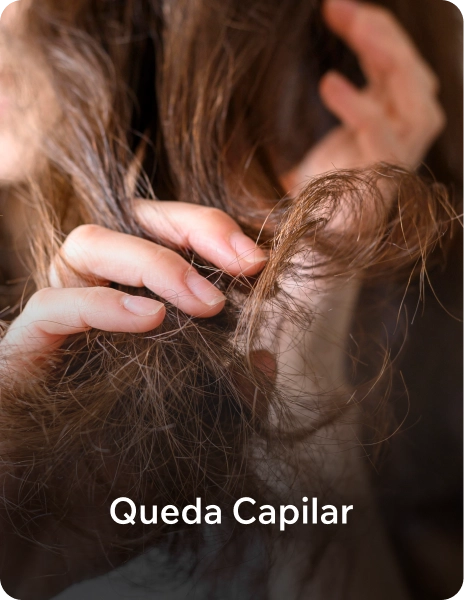 queda_capilar
