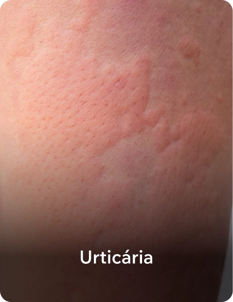 urtic_ria